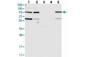 Western blot analysis of Lane 1: RT-4, Lane 2: U-251 MG, Lane 3: Human Plasma, Lane 4: Liver, Lane 5: Tonsil with KIAA0753 polyclonal antibody  at 1:250-1:500 dilution. (KIAA0753 抗体)
