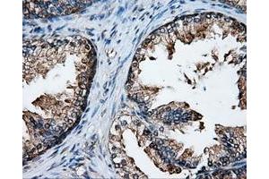 Immunohistochemical staining of paraffin-embedded Kidney tissue using anti-XRCC1mouse monoclonal antibody. (XRCC1 抗体)