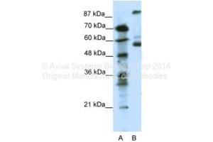 Host: Rabbit Target Name: HTR7 Sample Tissue: Human Jurkat Antibody Dilution: 1ug/ml (HTR7 抗体  (N-Term))