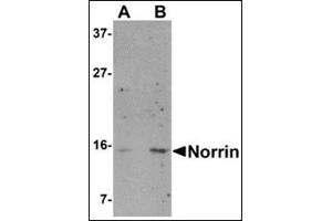 Western blot analysis of Norrin in Jurkat cell lysate with this product at (A) 1 and (B) 2 μg/ml. (Norrie Disease (Pseudoglioma) 抗体  (N-Term))
