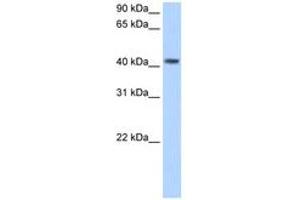 Image no. 1 for anti-Pregnancy Specific beta-1-Glycoprotein 5 (PSG5) (AA 71-120) antibody (ABIN204983) (PSG5 抗体  (AA 71-120))