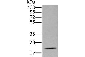 Western blot analysis of Mouse fat tissue lysate using ZFAND5 Polyclonal Antibody at dilution of 1:500 (ZFAND5 抗体)