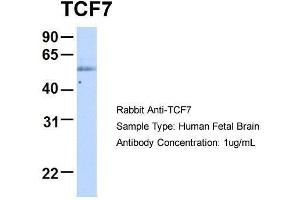 Host:  Rabbit  Target Name:  TCF7  Sample Type:  Human Fetal Brain  Antibody Dilution:  1. (TCF7 抗体  (Middle Region))