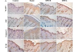 Immunohistochemistry (Paraffin-embedded Sections) (IHC (p)) image for anti-Interleukin 1, beta (IL1B) (AA 101-200) antibody (ABIN728503)
