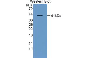 Western blot analysis of the recombinant protein. (FAM19A3 抗体  (AA 30-129))