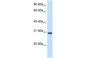 KCTD6 antibody used at 5 ug/ml to detect target protein. (KCTD6 抗体  (N-Term))