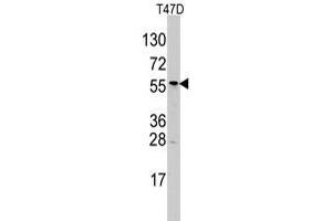 Western blot analysis of ALDH6A1 polyclonal antibody  in T-47D cell line lysates (35 ug/lane). (ALDH6A1 抗体  (N-Term))