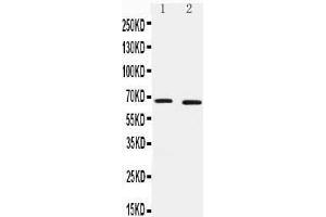 Anti-IRAKM antibody,  Western blotting Lane 1: HELA Cell Lysate Lane 2: JURKAT Cell Lysate (IRAK3 抗体  (C-Term))