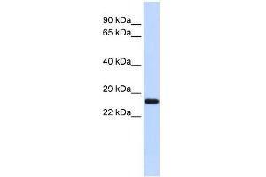 SOD2 antibody used at 1 ug/ml to detect target protein. (SOD2 抗体  (N-Term))