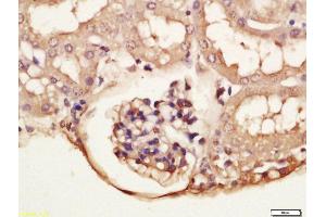 Immunohistochemistry (Paraffin-embedded Sections) (IHC (p)) image for anti-Glucocorticoid Receptor DNA Binding Factor 1 (GRLF1) (pTyr1087) antibody (ABIN2174954)