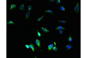 Immunofluorescent analysis of U251 cells using ABIN7149126 at dilution of 1:100 and Alexa Fluor 488-congugated AffiniPure Goat Anti-Rabbit IgG(H+L) (UBXN11 抗体  (AA 38-146))