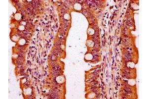 Immunohistochemistry (IHC) image for anti-Solute Carrier Family 6 (Neutral Amino Acid Transporter), Member 19 (SLC6A19) (AA 326-413) antibody (ABIN7169980)