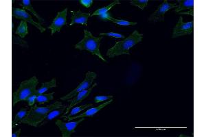 Immunofluorescence of monoclonal antibody to TLN1 on HeLa cell. (TLN1 抗体  (AA 1324-1424))