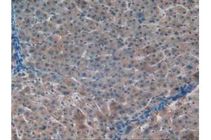 IHC-P analysis of Human Liver Tissue, with DAB staining. (APOC1 抗体  (AA 31-83))