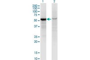 Western Blot analysis of GPI expression in transfected 293T cell line by GPI monoclonal antibody (M01), clone 8B8. (GPI 抗体  (AA 1-558))