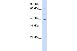 WB Suggested Anti-SPATA7 Antibody Titration: 0. (SPATA7 抗体  (Middle Region))
