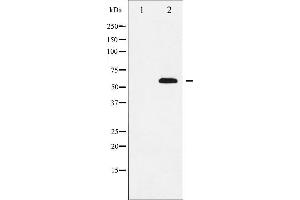 Western blot analysis of SOX9 expression in NIH-3T3 whole cell lysates,The lane on the left is treated with the antigen-specific peptide. (SOX9 抗体)