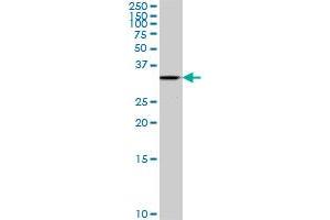 ALS2CR7 polyclonal antibody (A01), Lot # CRU5060602QCS1. (Cyclin-Dependent Kinase 15 (ALS2CR7) (AA 242-347) 抗体)