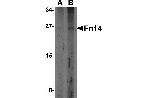 Western Blotting (WB) image for anti-Tumor Necrosis Factor Receptor Superfamily, Member 12A (TNFRSF12A) antibody (ABIN1031803) (TNFRSF12A 抗体)
