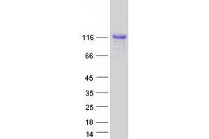Western Blotting (WB) image for Calpastatin (CAST) (Transcript Variant 10) protein (Myc-DYKDDDDK Tag) (ABIN2713065)