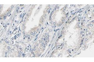ABIN6274988 at 1/100 staining Human prostate tissue by IHC-P. (CEP170 抗体  (Internal Region))