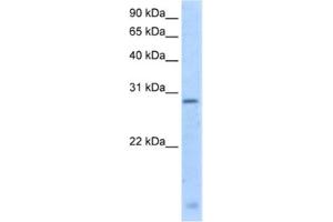 Western Blotting (WB) image for anti-Regulator of G-Protein Signalling 18 (RGS18) antibody (ABIN2462635) (RGS18 抗体)