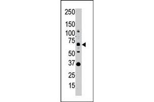 Western blot analysis of SENP1 polyclonal antibody  in whole HL-60 cell lysate : SENP1 (Arrow) was detected using purified polyclonal antibody. (SENP1 抗体  (N-Term))