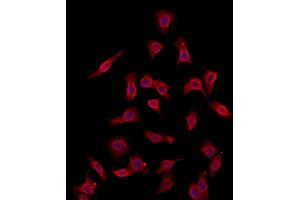 ABIN6260812 and ABIN6273100 staining HepG2 by IF/ICC. (CHMP4B 抗体  (N-Term))