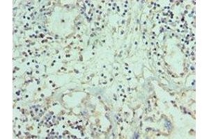 Immunohistochemistry of paraffin-embedded human prostate tissue using ABIN7173794 at dilution of 1:100 (TWEAK 抗体  (AA 42-123))