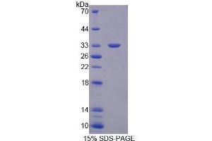 Image no. 1 for Tubulin Folding Cofactor B (TBCB) (AA 1-244) protein (His tag) (ABIN6239643) (TBCB Protein (AA 1-244) (His tag))