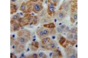 Used in DAB staining on fromalin fixed paraffin-embedded Liver tissue (ANXA6 抗体  (AA 251-504))