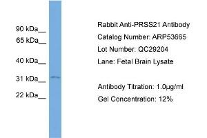 WB Suggested Anti-PRSS21  Antibody Titration: 0. (PRSS21 抗体  (N-Term))