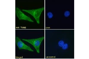 ABIN1590057 Immunofluorescence analysis of paraformaldehyde fixed HeLa cells, permeabilized with 0. (TNNI3 抗体  (AA 117-127))