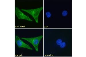 ABIN1590057 Immunofluorescence analysis of paraformaldehyde fixed HeLa cells, permeabilized with 0.