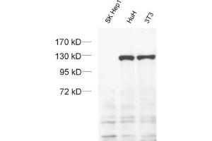 dilution: 1 : 1000 (ECL), sample: SK-Hep1 cell with a homozygous deletion of exportin 4. (XPO4 抗体  (AA 927-1151))