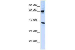 C6ORF134 antibody used at 1 ug/ml to detect target protein. (Chromosome 6 Open Reading Frame 134 (C6orf134) (Middle Region) 抗体)