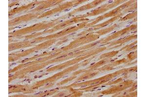 IHC image of ABIN7156473 diluted at 1:300 and staining in paraffin-embedded human heart tissue performed on a Leica BondTM system. (ITGB1BP1 抗体  (AA 1-200))