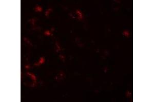 Immunofluorescencent staining of human brain cells with AXIN1 polyclonal antibody  at 20 ug/mL. (Axin 抗体  (C-Term))