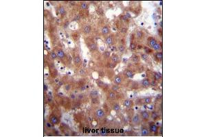 HSD17B4 Antibody (Center) (ABIN656447 and ABIN2845732) immunohistochemistry analysis in formalin fixed and paraffin embedded human liver tissue followed by peroxidase conjugation of the secondary antibody and DAB staining. (HSD17B4 抗体  (AA 341-370))