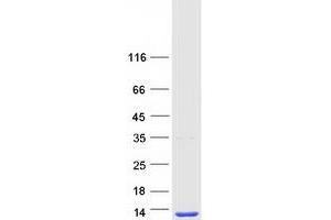 Western Blotting (WB) image for Secretoglobin, Family 1A, Member 1 (Uteroglobin) (SCGB1A1) protein (Myc-DYKDDDDK Tag) (ABIN2731461)