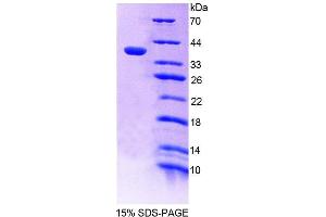 SDS-PAGE analysis of Human PTPN12 Protein. (PTPN12 蛋白)