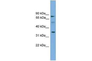 WB Suggested Anti-OSTalpha Antibody Titration: 0. (OST alpha 抗体  (Middle Region))