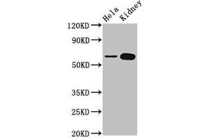 Western Blotting (WB) image for anti-TROVE Domain Family, Member 2 (TROVE2) (AA 3-535) antibody (ABIN7142715)