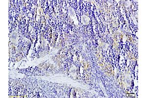 Formalin-fixed and paraffin-embedded: rat spleen tissue labeled with Rabbit Anti-TNFSF14 Polyclonal Antibody, Unconjugated (ABIN740625) 1:200 followed by conjugation to the secondary antibody and DAB staining (TNFSF14 抗体  (AA 141-240))