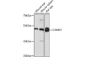 Western blot analysis of extracts of various cell lines, using CAMKV Rabbit pAb (ABIN7266051) at 1:1000 dilution. (CAMKV 抗体  (AA 1-285))