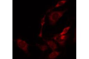 ABIN6274831 staining Hela by IF/ICC. (ACER2 抗体)