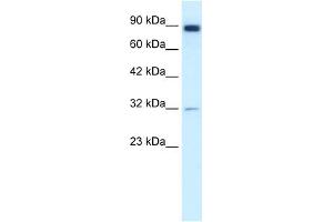 WB Suggested Anti-MMP9 Antibody Titration:  1. (MMP 9 抗体  (N-Term))