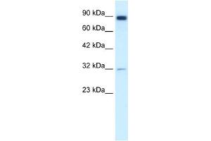Western Blotting (WB) image for anti-Matrix Metallopeptidase 9 (Gelatinase B, 92kDa Gelatinase, 92kDa Type IV Collagenase) (MMP9) (N-Term) antibody (ABIN2777743)