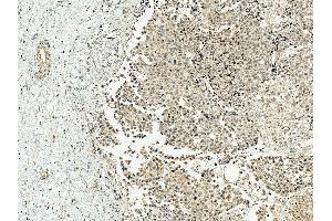 Immunohistochemistry analysis using Rabbit Anti-CBP Polyclonal Antibody (ABIN5667461). (CBP 抗体  (AA 2100-2200) (HRP))