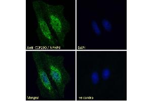 ABIN334371 Immunofluorescence analysis of paraformaldehyde fixed HeLa cells, permeabilized with 0.